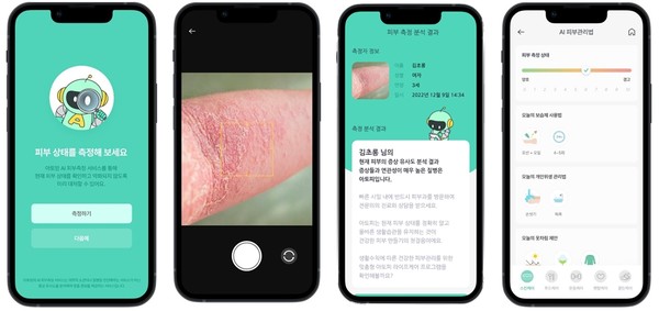 /사진= 아토맘, AI 피부건강측정서비스’ 앱 서비스 화면